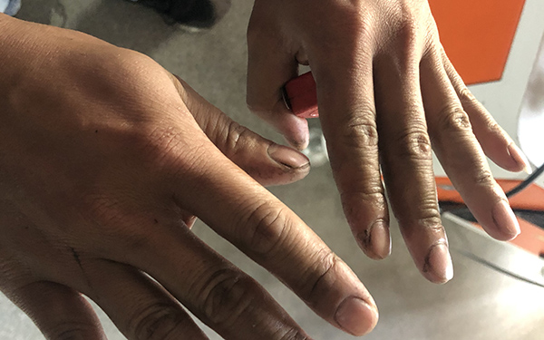 做線切割手（shǒu）上油汙洗不（bú）幹淨怎麽辦